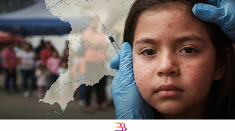 Encienden alertas por el SARAMPIÓN en Nayarit